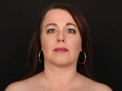Neck and Chin Liposuction After