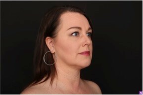 Neck and Chin Liposuction After
