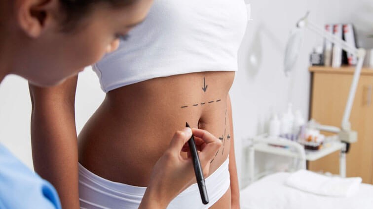 Top Ten Tummy Tuck Trends in 2021 – Best Practices in Abdominoplasty Surgery