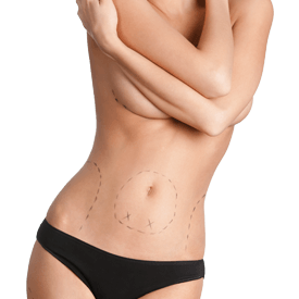 After Weight Loss Surgery  Image
