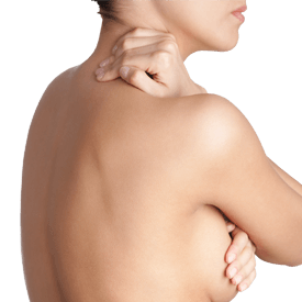 Breast Revision Image