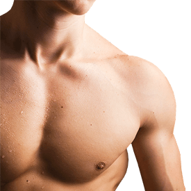 Gynecomastia Image