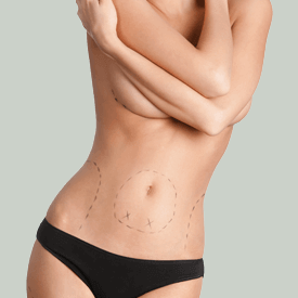 After Weight Loss Surgery