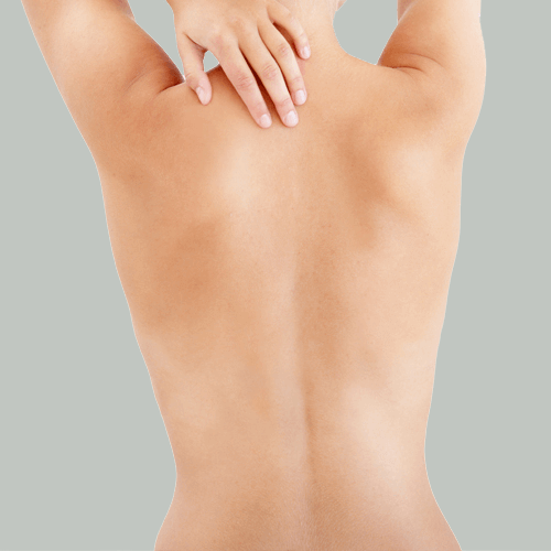 Skin Cancer Cosmetic Treatment