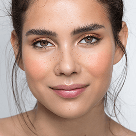Lip Lift